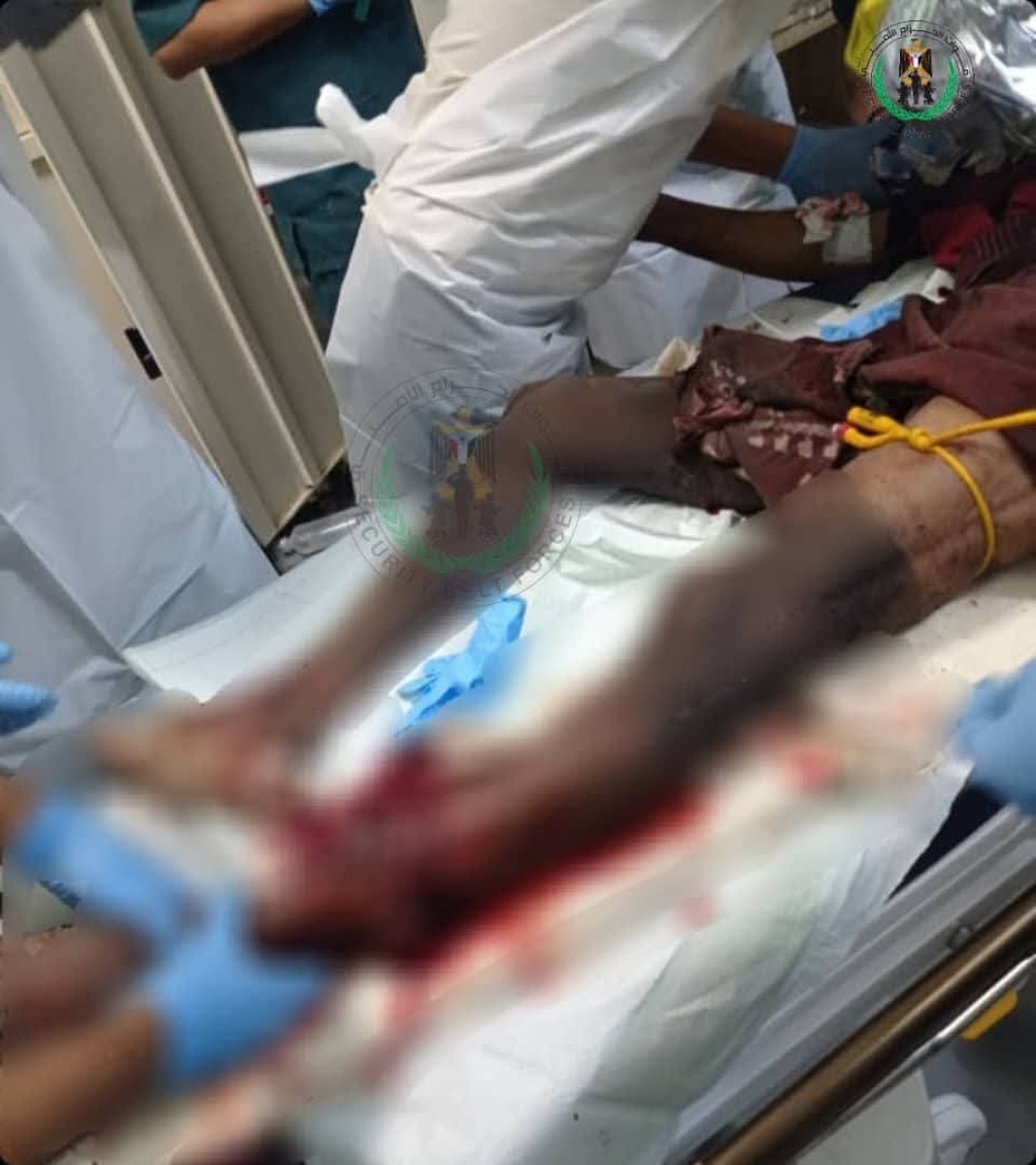 الحزام الأمني يكشف تفاصيل انفجار الدراجة النارية في الضالع