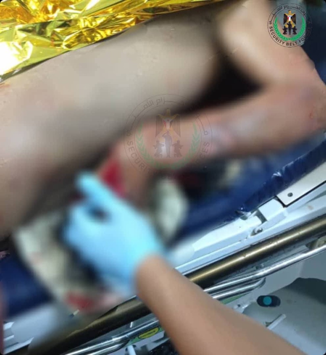 الحزام الأمني يكشف تفاصيل انفجار الدراجة النارية في الضالع