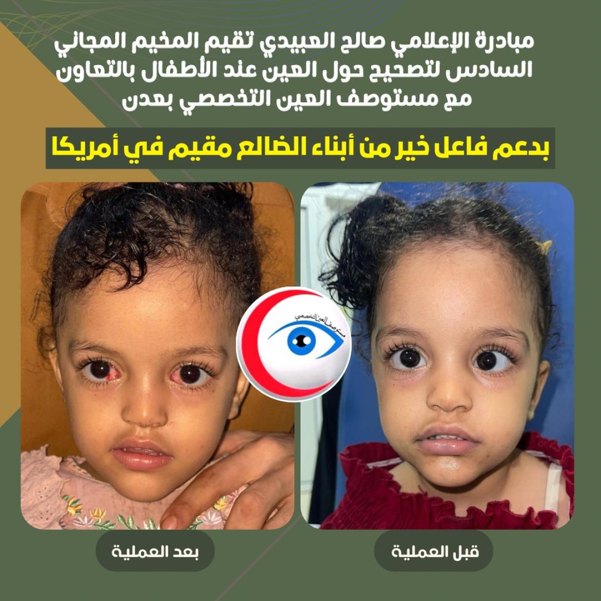 لليوم الثاني.. استمرار المخيم السادس لتصحيح الحول في عدن