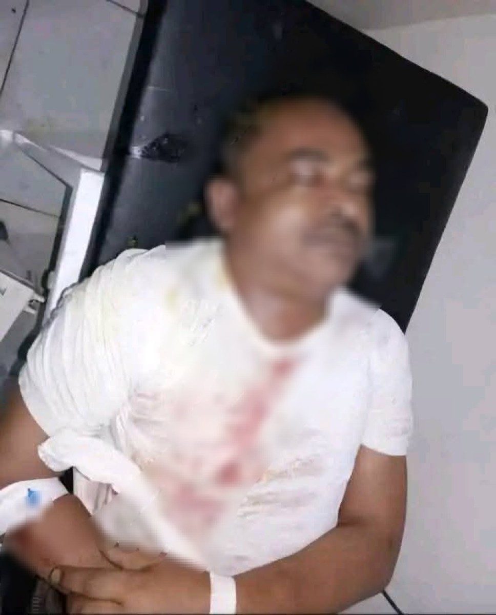 وفاة نزيل في السجن المركزي بالضالع قبل تنفيذ حكم الإعدام بحقه