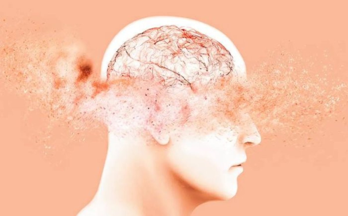 Inactivity increases the risk of developing Alzheimer's