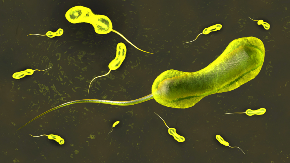From Yemen to France... the spread of a highly drug-resistant strain of cholera
