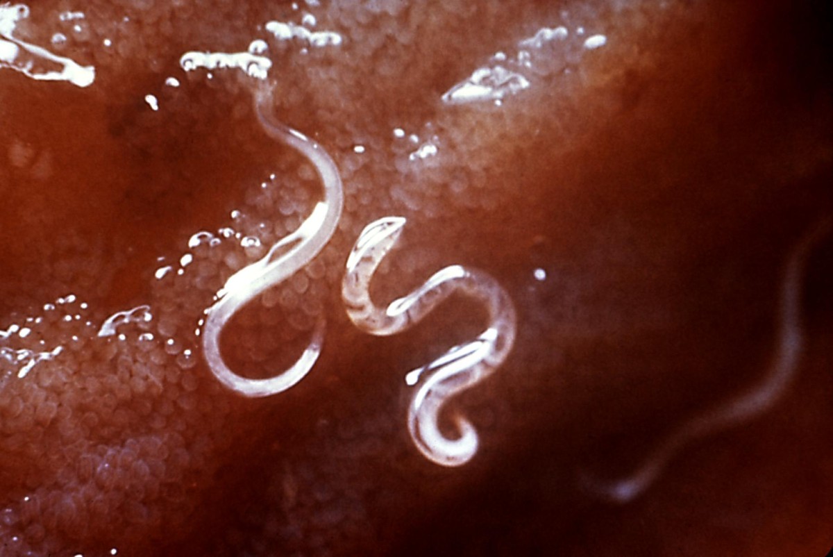 For the first time... the spread of skin disease "Ancylostoma" in Hodeidah