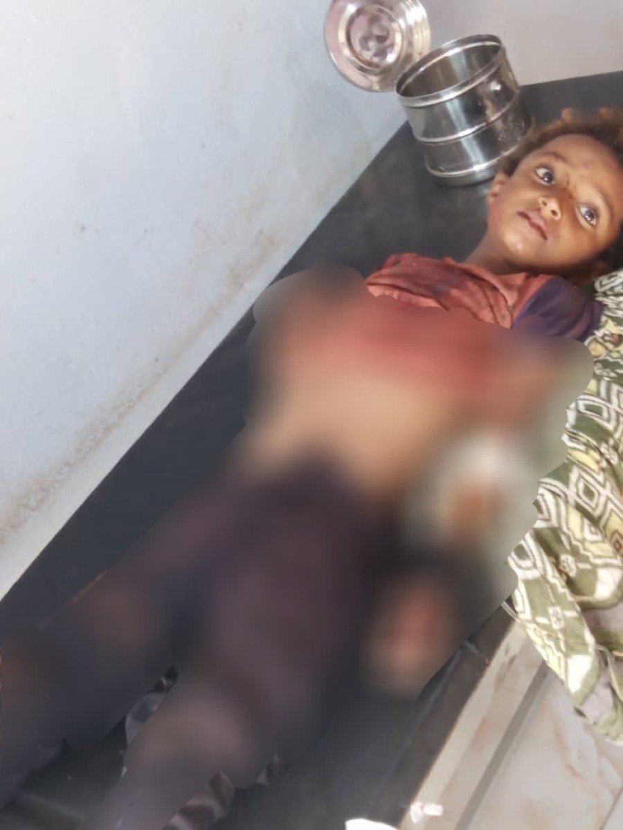 A child was killed and three others were injured by Houthi bombing on the Shamir area, west of Taiz