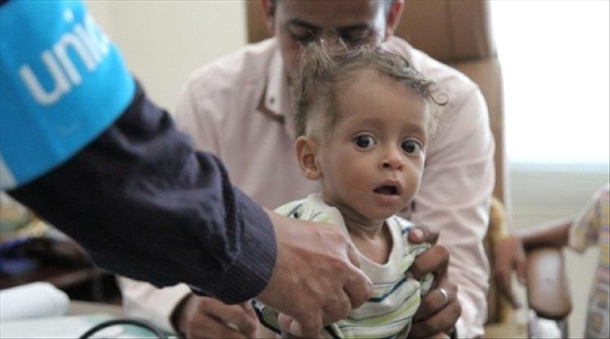 Yemen has the highest rates of malnutrition in the world