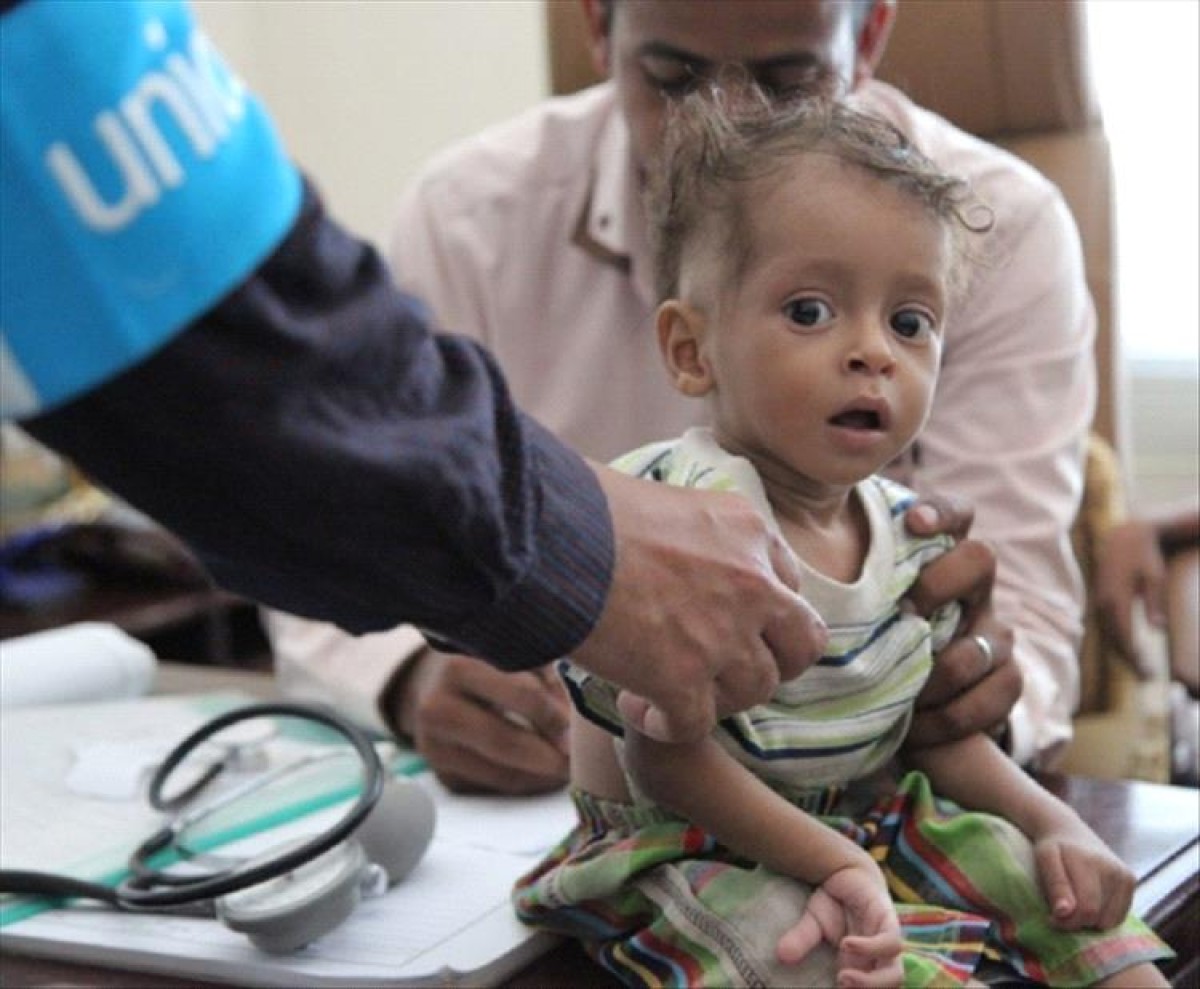A UN report confirming the deprivation of 654,000 children and women of the treatment of malnutrition