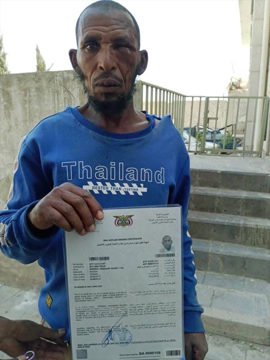 An unjustified assault on an Ethiopian resident in Dhamar raises a wave of discontent
