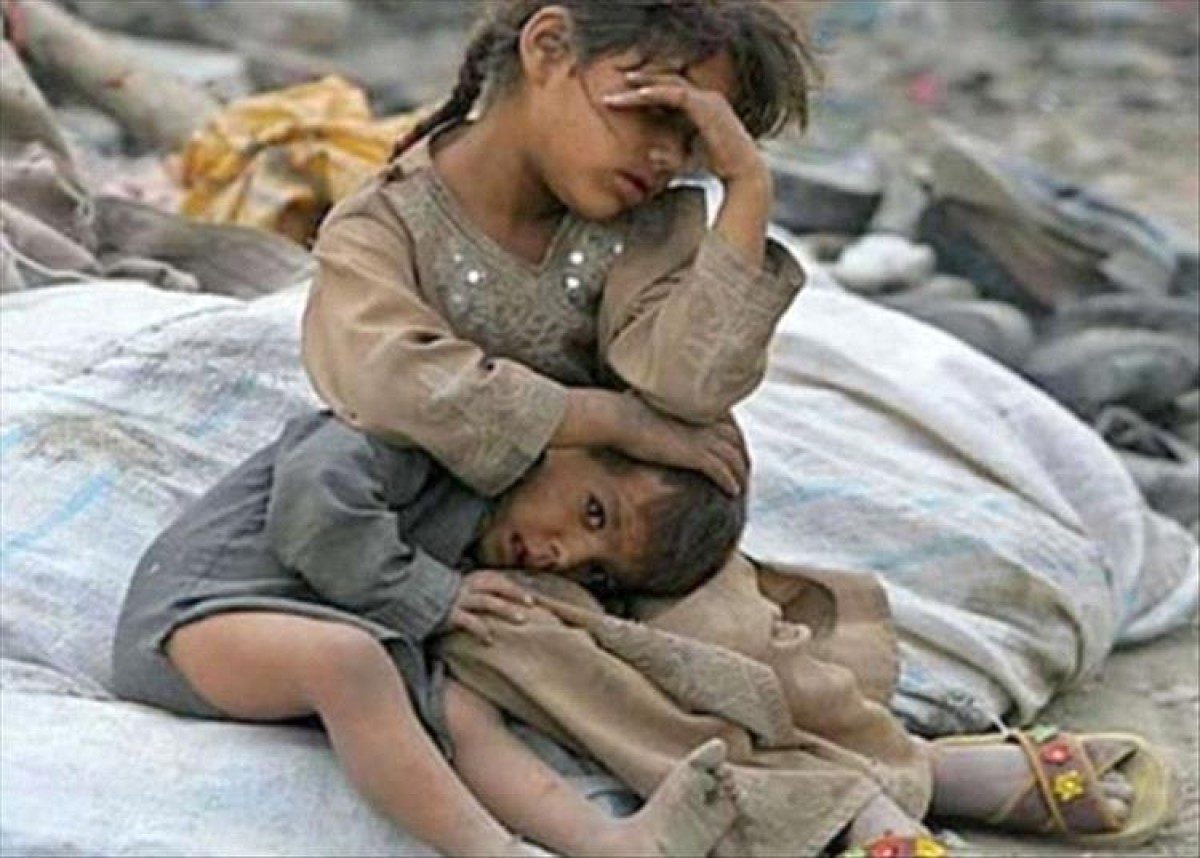 United Nations: Hunger rates are witnessing a continuous rise in Yemen